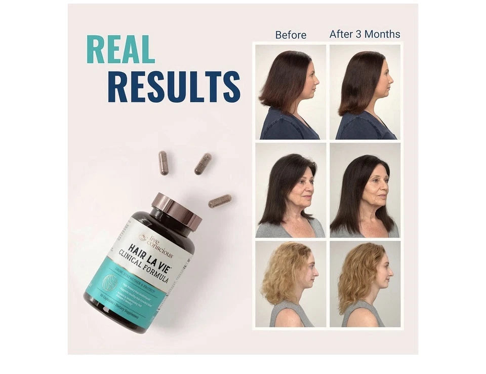 Hair La Vie Live Conscious Clinical Formula Hair Growth Supplement for Women & Men – 90 Capsules